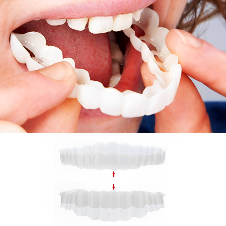 SmilePro Zahnveneers – Perfektes Lächeln für Zähne mit Veneers, FDA-zugelassen 0