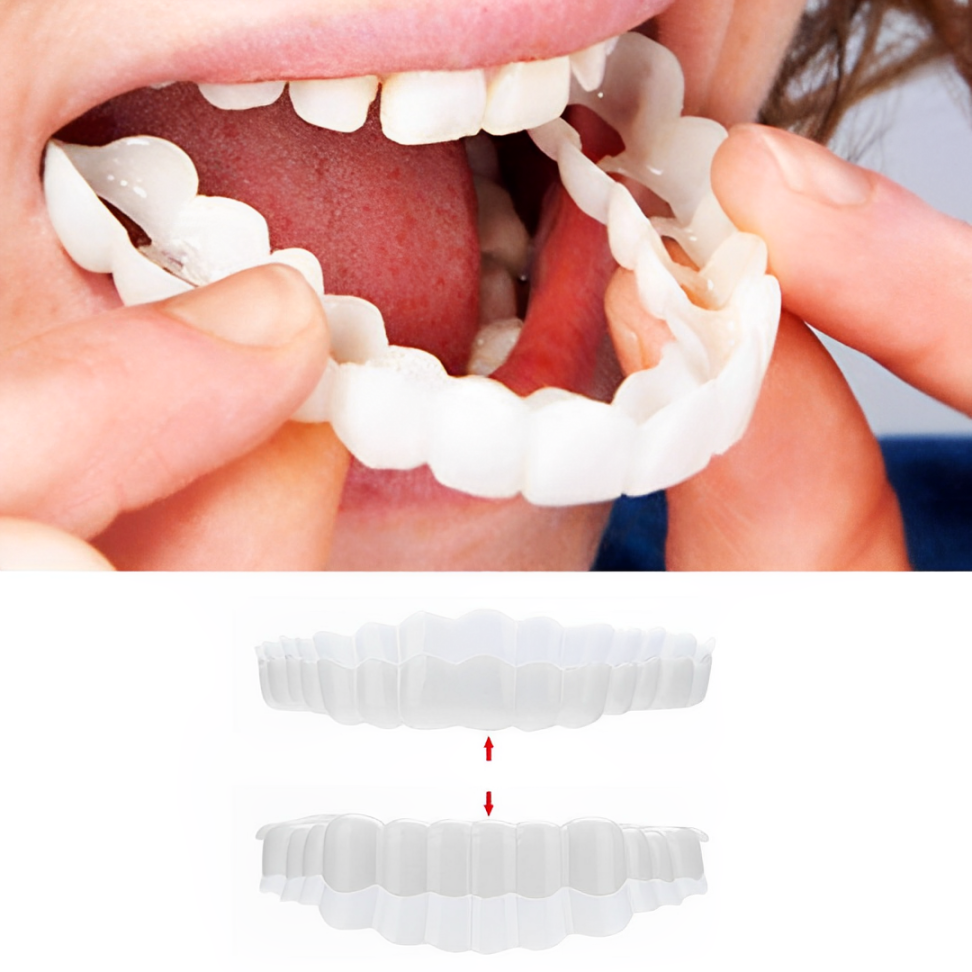SmilePro Zahnveneers – Perfektes Lächeln für Zähne mit Veneers, FDA-zugelassen 0