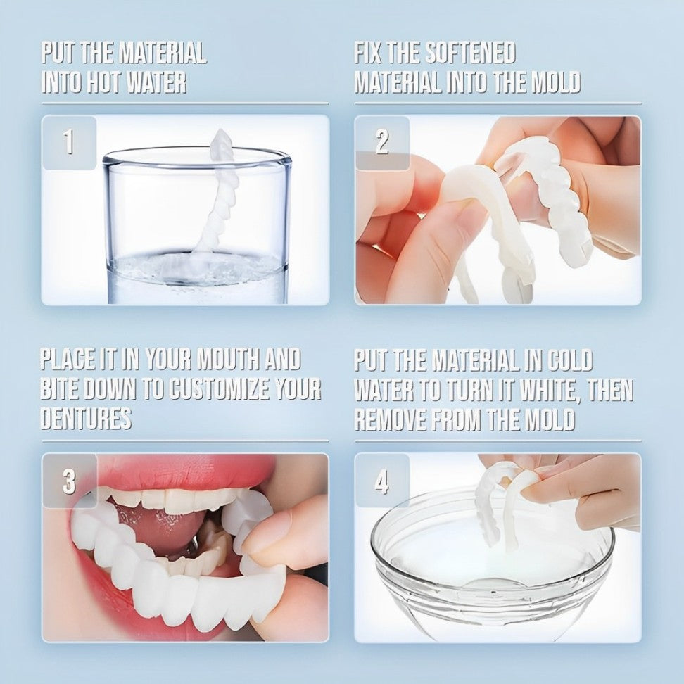 SmilePro Zahnveneers – Perfektes Lächeln für Zähne mit Veneers, FDA-zugelassen 6