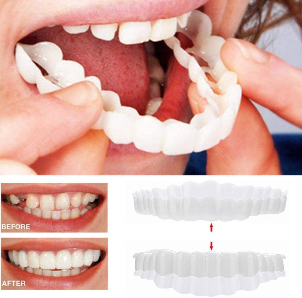 SmileVeneer – Hochwertige Zahnverblendungen für Strahlendes Lächeln & Zähne Verblenden 1