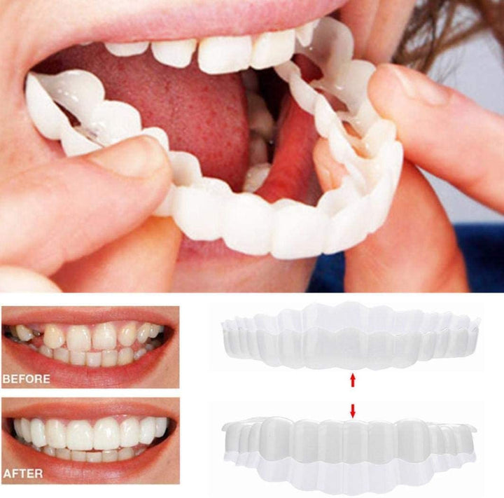 SmileVeneer – Hochwertige Zahnverblendungen für Strahlendes Lächeln & Zähne Verblenden 1