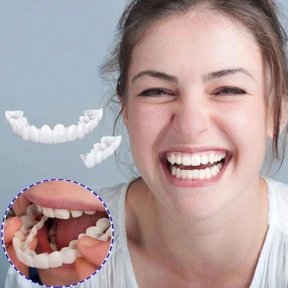 SmileVeneer – Hochwertige Zahnverblendungen für Strahlendes Lächeln & Zähne Verblenden 2