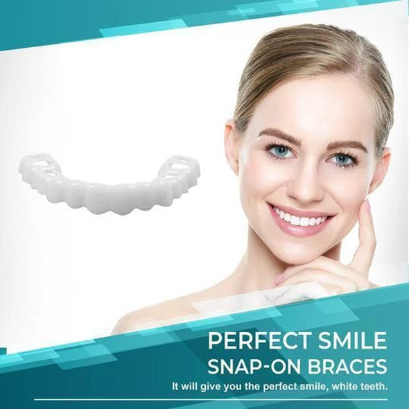 SmileVeneer – Hochwertige Zahnverblendungen für Strahlendes Lächeln & Zähne Verblenden 3