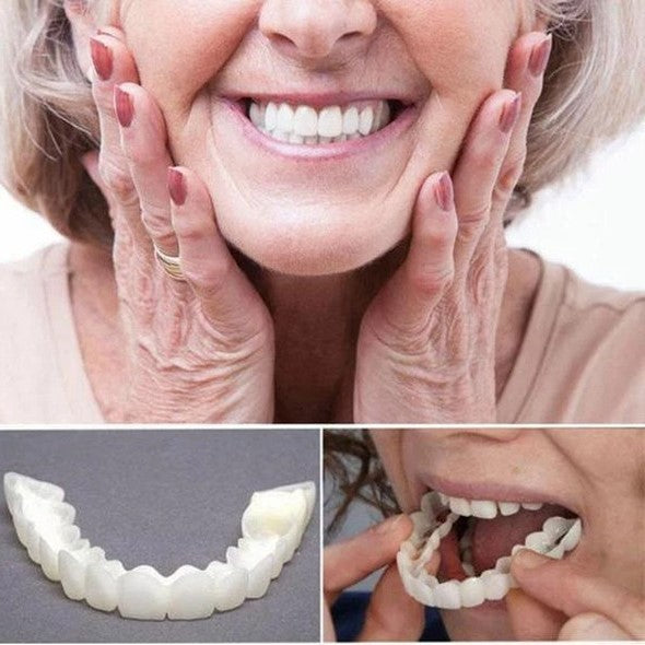 SmileVeneer – Hochwertige Zahnverblendungen für Strahlendes Lächeln & Zähne Verblenden 4