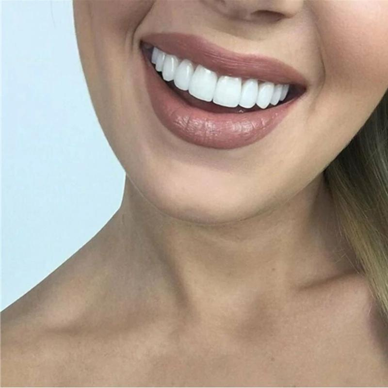 WhiteSmile – Sofort Zahnersatz Zahnprothese Für Strahlend Weiße Zähne 1