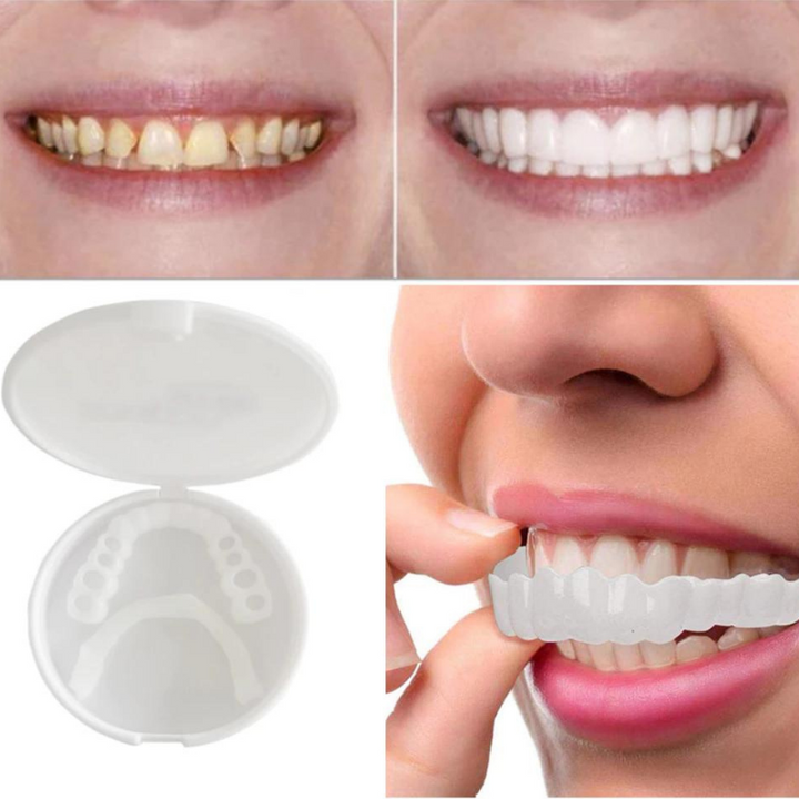 WhiteSmile – Sofort Zahnersatz Zahnprothese Für Strahlend Weiße Zähne 2