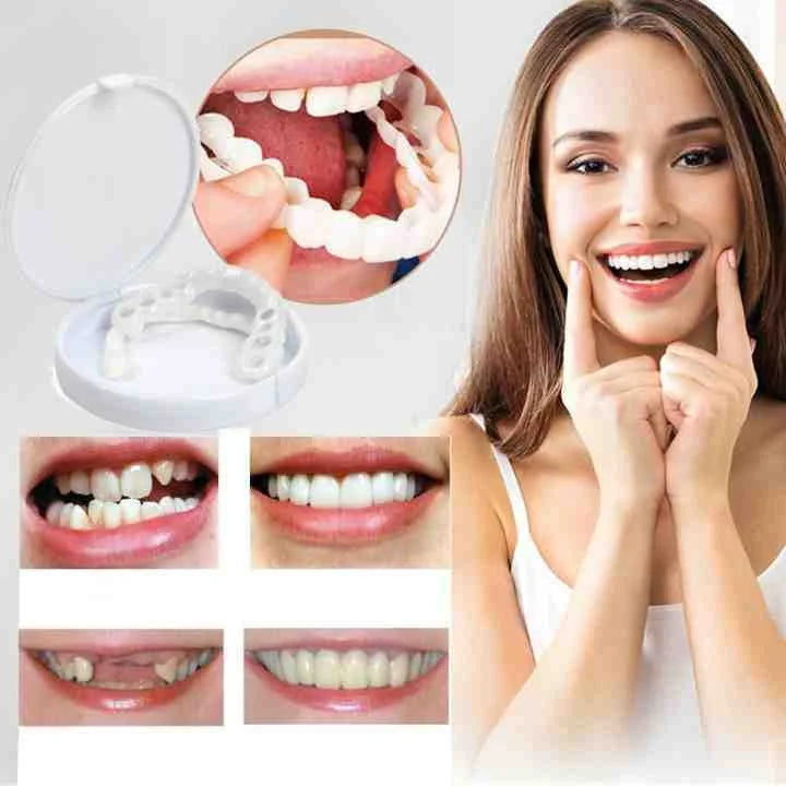 WhiteSmile – Sofort Zahnersatz Zahnprothese Für Strahlend Weiße Zähne 3